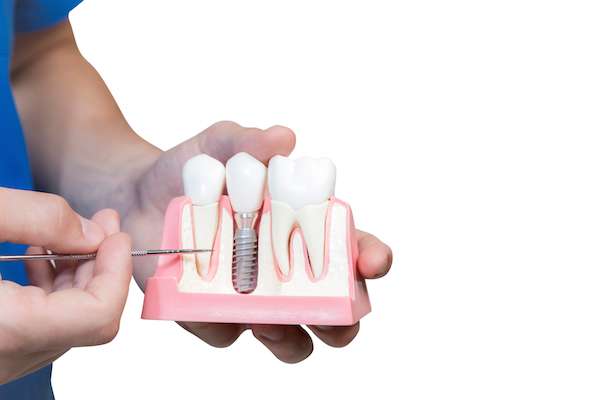 Can You Get Dental Implants if You Have Gum Disease from Korsmo Family Dental in Tacoma, WA