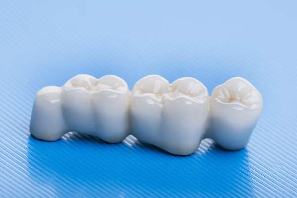 How Many Teeth Can Dental Bridges Replace from Korsmo Family Dental in Tacoma, WA