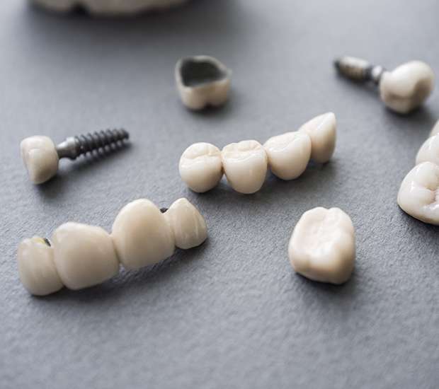 Tacoma The Difference Between Dental Implants and Mini Dental Implants