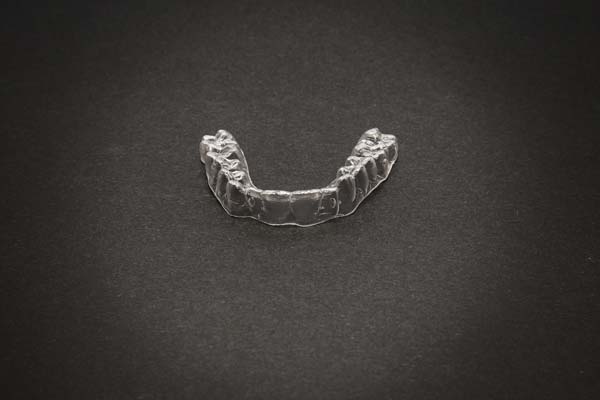 Six FAQs About Invisalign