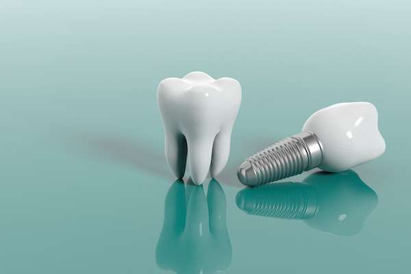 Questions to Ask Your Implant Dentist from Korsmo Family Dental in Tacoma, WA