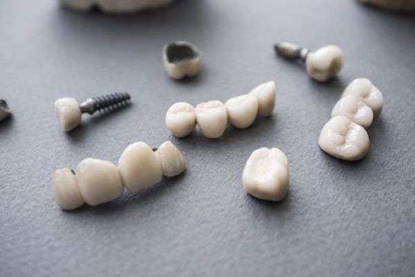 Types of Dental Implants from Korsmo Family Dental in Tacoma, WA